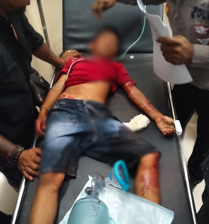 Bersepeda Masuk Kolong Mobil Pick Up, Pelajar SD&nbsp;Meninggal